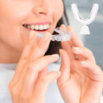Kit Clareador Dental Whiteness Perfect 16% + Moldeiras - Imagem 5